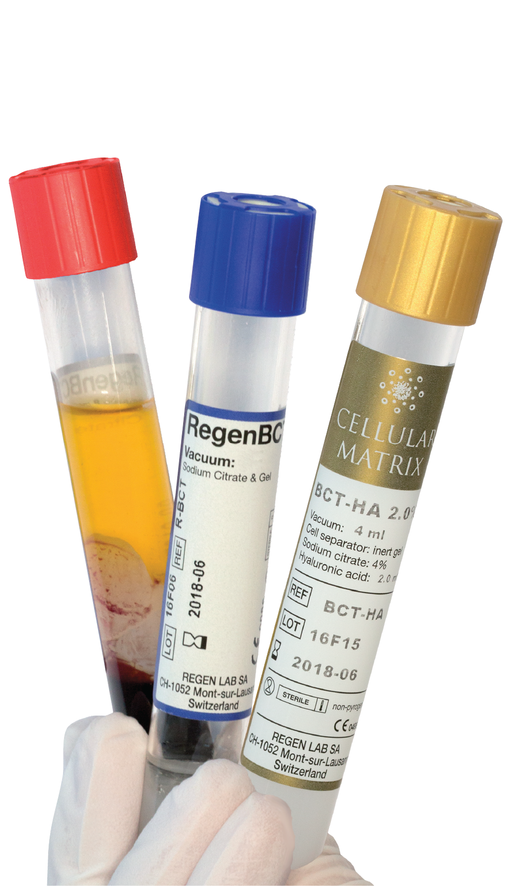 Demonstrationsbild einer PRP-Behandlung